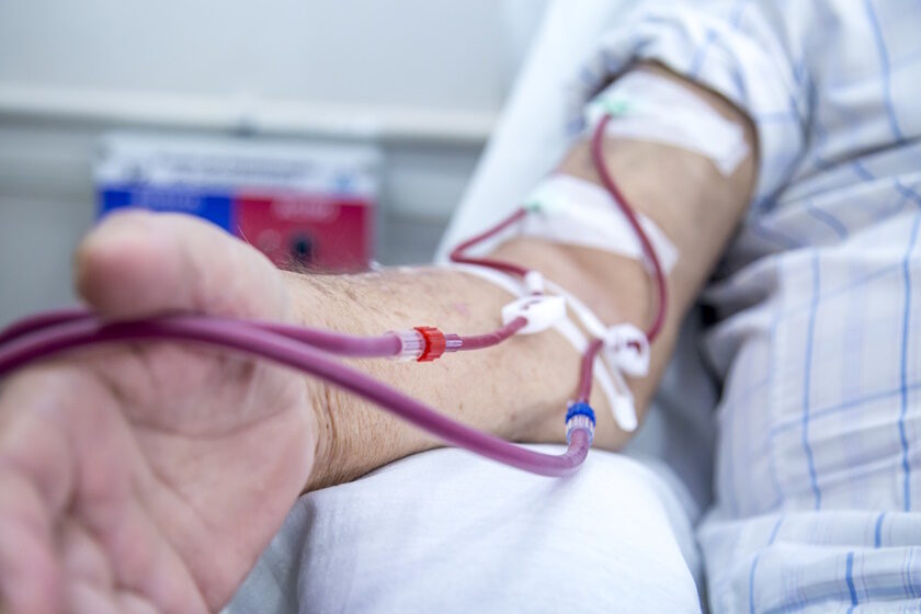 hemodialysis in people on the equipment